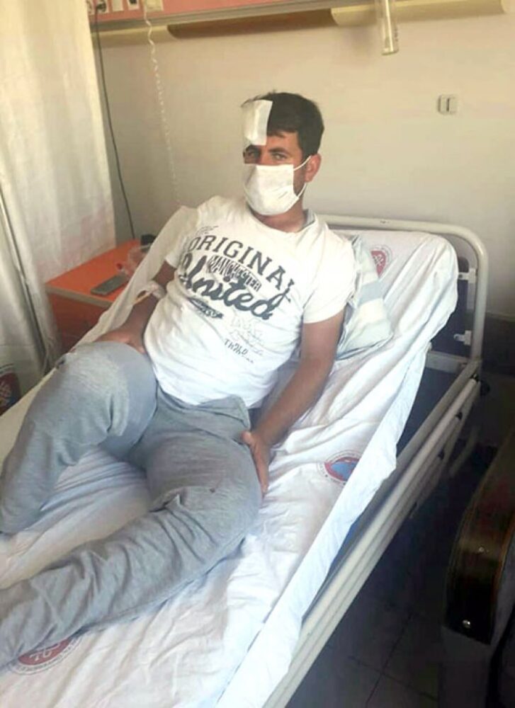 Geçmiş Olsun ve Baş Sağlığı Diliyoruz.